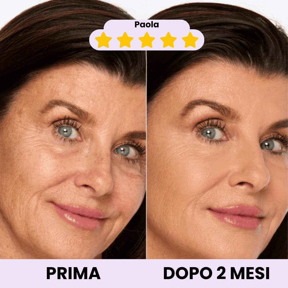 Idro-Tensore – Riempie le rughe, Lifta i tratti & Illumina l'incarnato